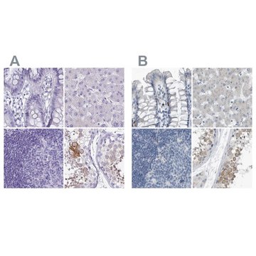Anti-ZPBP2 antibody produced in rabbit