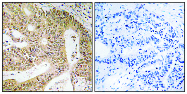 Anti-DAP antibody produced in rabbit