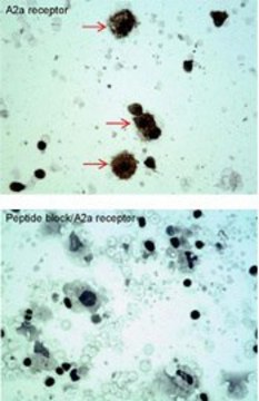 Anti-ADORA2A (C-terminal) antibody produced in