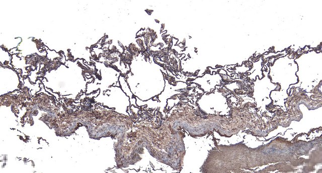 Anti-ARAP1 (C-terminal) antibody produced in