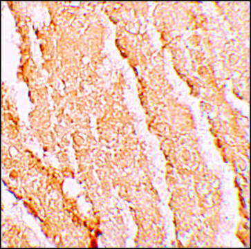 Anti-VPS39 antibody produced in rabbit