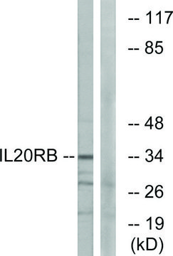 Anti-IL20RB antibody produced in rabbit