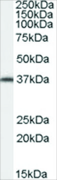 Anti-AIP/ARA9 antibody produced in goat