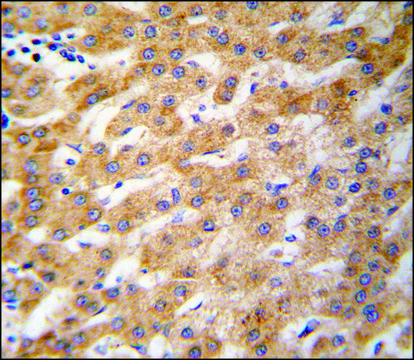 Anti-ARMC6 (N-term) antibody produced in
