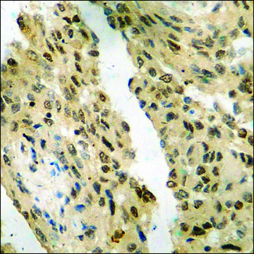 Anti-phospho-FKHR (pSer²??) antibody produced in
