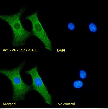 Anti-PNPLA2/ATGL antibody produced in goat