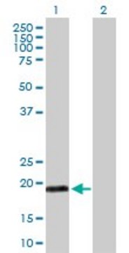 Anti-MYL5 antibody produced in rabbit