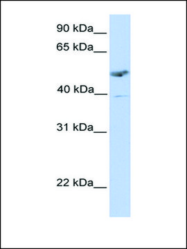 Anti-ST3GAL1 antibody produced in rabbit