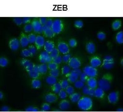 Anti-ZEB1 (N-terminal) antibody produced in
