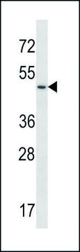 ANTI-UTS2R (CENTER) antibody produced in