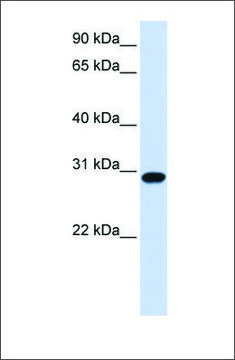 Anti-FOXR1 antibody produced in rabbit