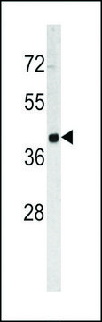 ANTI-TROP2 (CENTER) antibody produced in