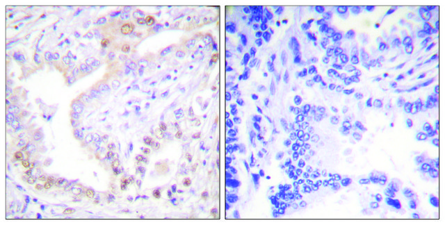 Anti-Lamin A (Cleaved-Asp²³?) antibody produced