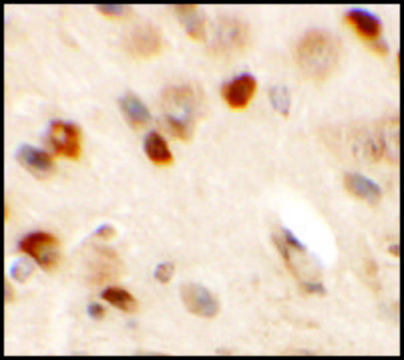 Anti-CMYA5 antibody produced in rabbit