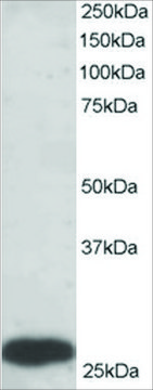 Anti-PGAM1/PGAM2/PGAM4 antibody produced in goat