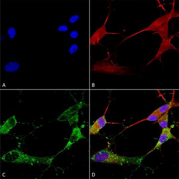 Monoclonal Anti-Asic1 - Rpe antibody