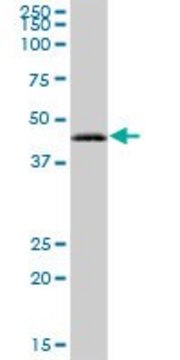 Anti-RAB3IL1 antibody produced in mouse