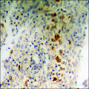 Anti-phospho-Nibrin (pSer²??) antibody produced in