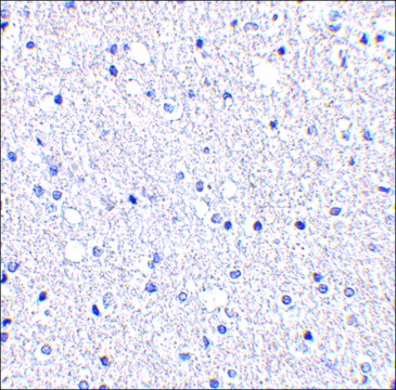 Anti-TIGAR (ab1) antibody produced in