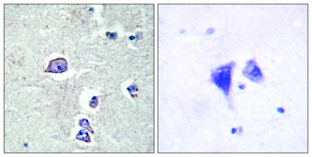 Anti-PDGFR ? antibody produced in