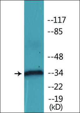Anti-phospho-CD32 (pTyr²?²) antibody produced in