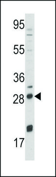 ANTI-NGFB (CENTER) antibody produced in