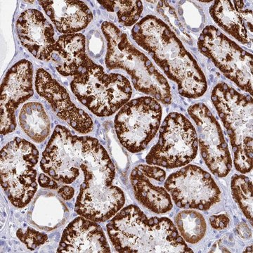 Anti-SETBP1 antibody produced in rabbit