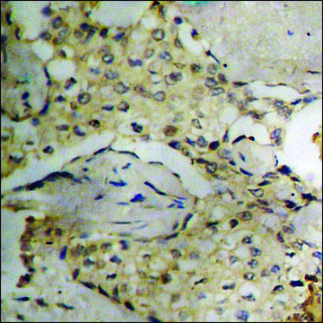 Anti-phospho-Synuclein-? (pTyr¹³?) antibody produced in