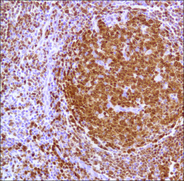 Anti-BOB-1 antibody, Rabbit monoclonal