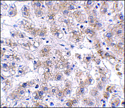 Anti-AFAP1L2 antibody produced in rabbit
