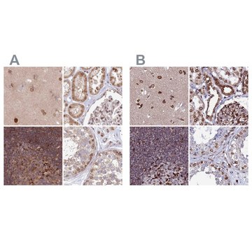 Anti-TOR1AIP1 antibody produced in rabbit