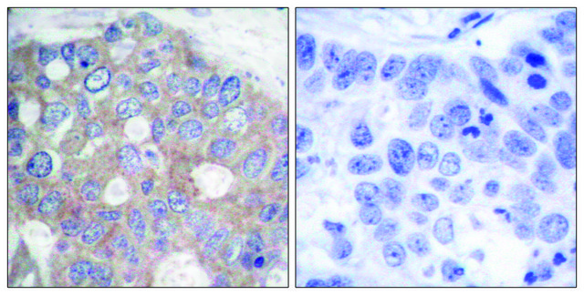 Anti-p70 S6 Kinase antibody produced
