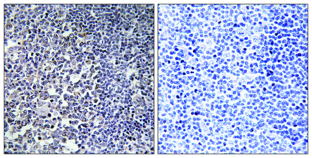 Anti-MRPS16 antibody produced in rabbit