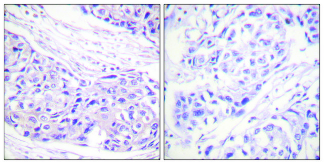 Anti-p90 RSK antibody produced in