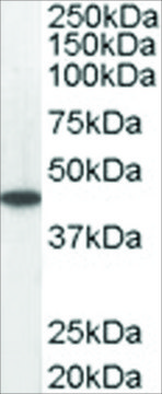 Anti-ACADM antibody produced in goat