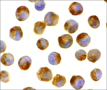 Anti-IL-21 antibody produced in rabbit