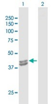 Anti-IVD antibody produced in rabbit