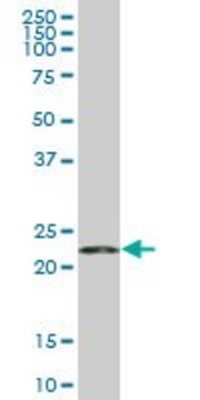 Monoclonal Anti-RPS5, (C-terminal) antibody produced