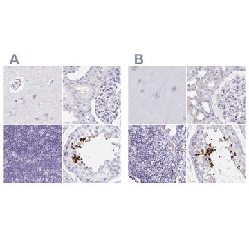 Anti-TEX44 antibody produced in rabbit