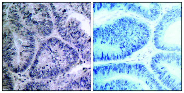 Anti-CHUK (Ab-23) antibody produced in