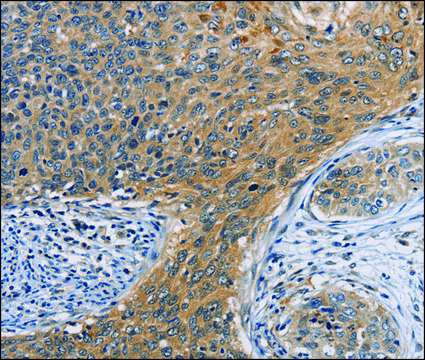 Anti-ORMDL3 antibody produced in rabbit