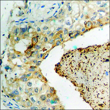 Anti-phospho-GluR1 (pSer???) antibody produced in