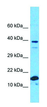 Anti-RPS19 (C-terminal) antibody produced in