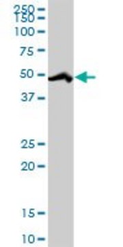 Anti-RBM39 antibody produced in rabbit