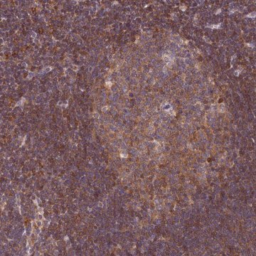 Anti-TRIM26 antibody produced in rabbit