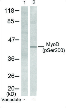 Anti-phospho-MYOD1 (pSer²??) antibody produced in