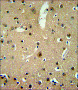 ANTI-NMB (CENTER) antibody produced in