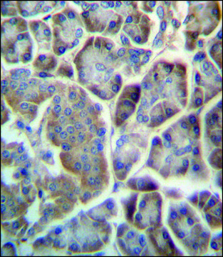 ANTI-TMED9 (C-TERM) antibody produced in