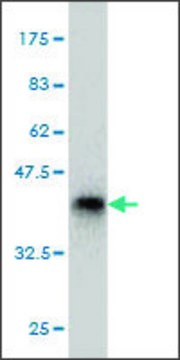 Monoclonal Anti-PHF2 antibody produced in