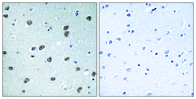 Anti-KLHL29 antibody produced in rabbit